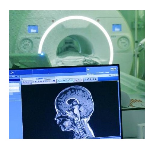 neurocirujano de cabeza